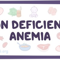 Integrative Medicine for Iron-Deficiency Anemia